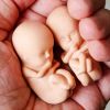 All Women Entitled To Safe & Legal Abortion, Distinction Between Married & Unmarried Women Unconstitutional : Supreme Court  https://www.livelaw.in/top-stories/rape-includes-marital-rape-for-the-purposes-of-mtp-act-wives-conceiving-out-of-forced-sex-can-seek-abortion-supreme-court-210551?infinitescroll=1